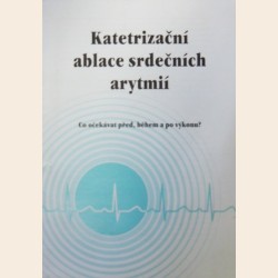 Katetrizační ablace srdečních arytmií